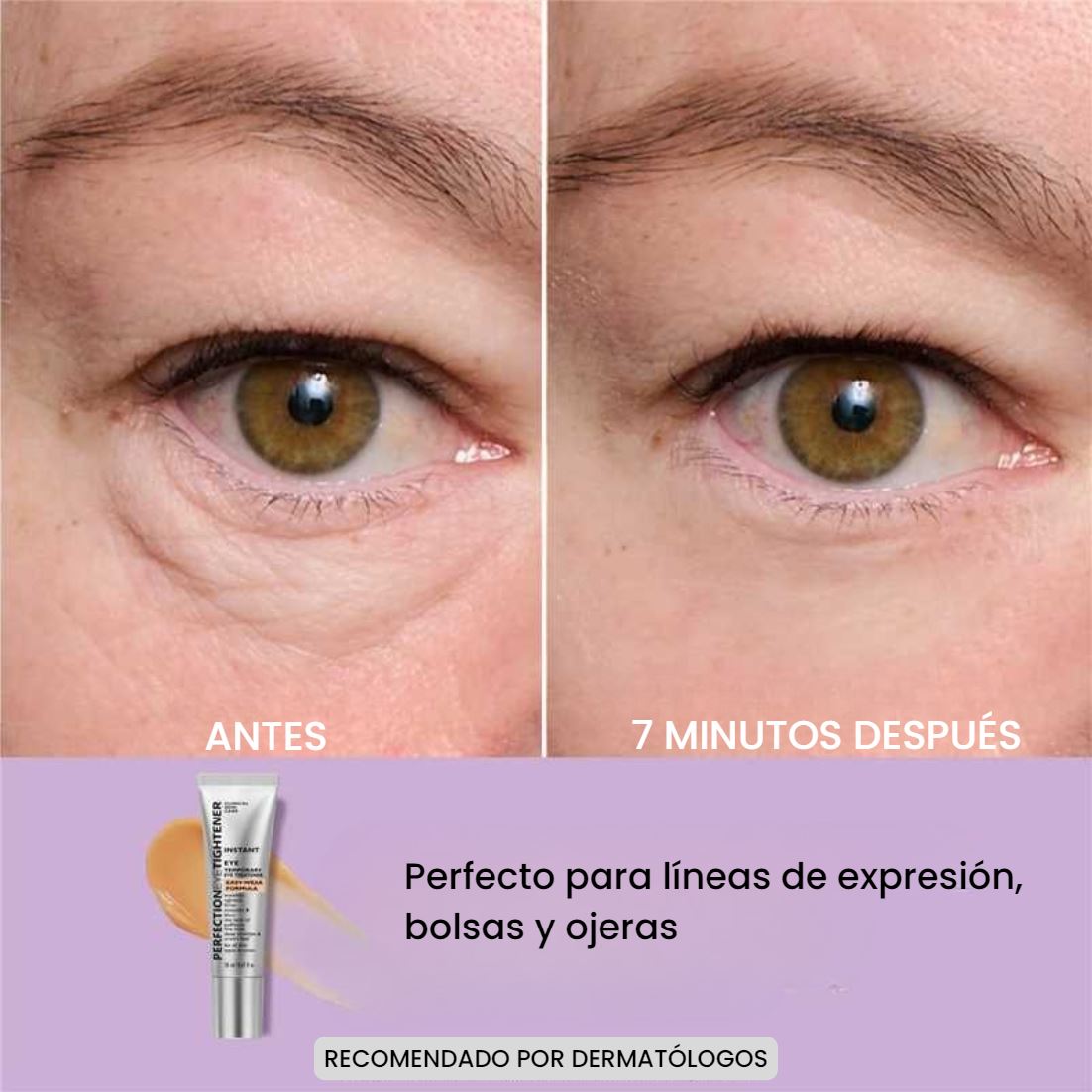 Reductor de bolsas y ojeras